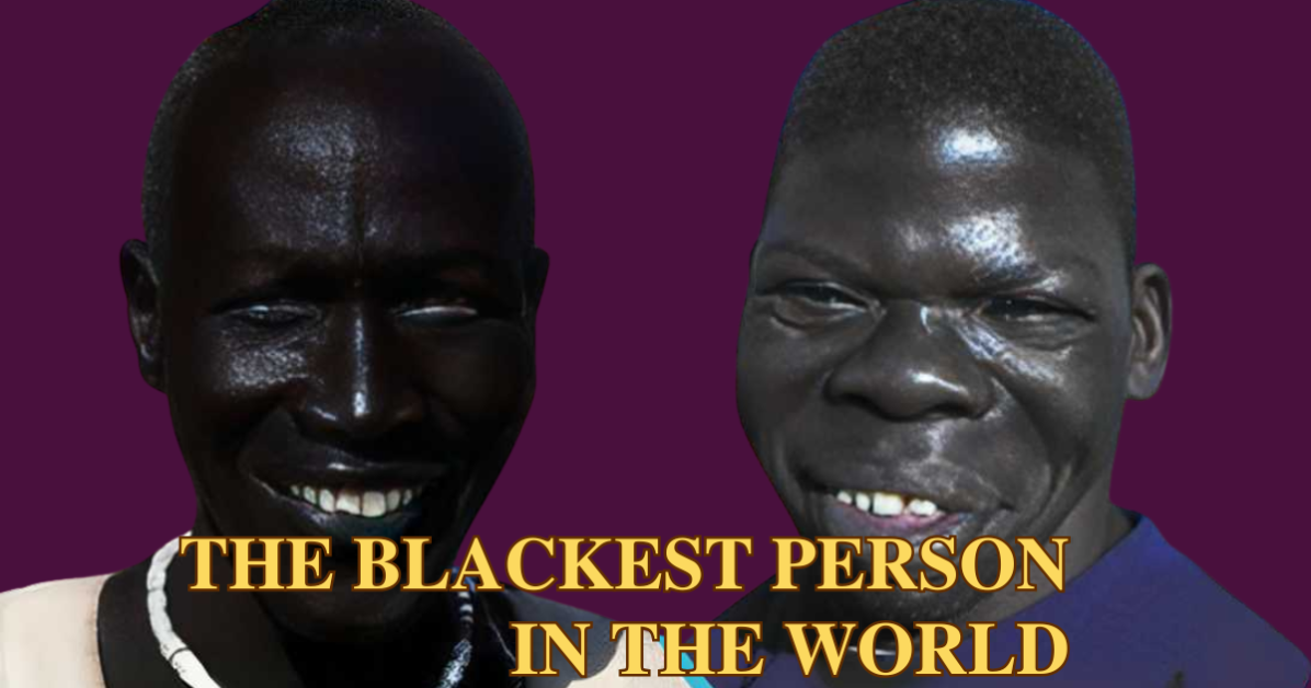 Who is the Blackest Person in the World? The Truth Revealed