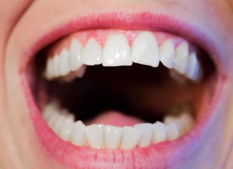 Improving Your Oral Health: Beyond Daily Brushing
