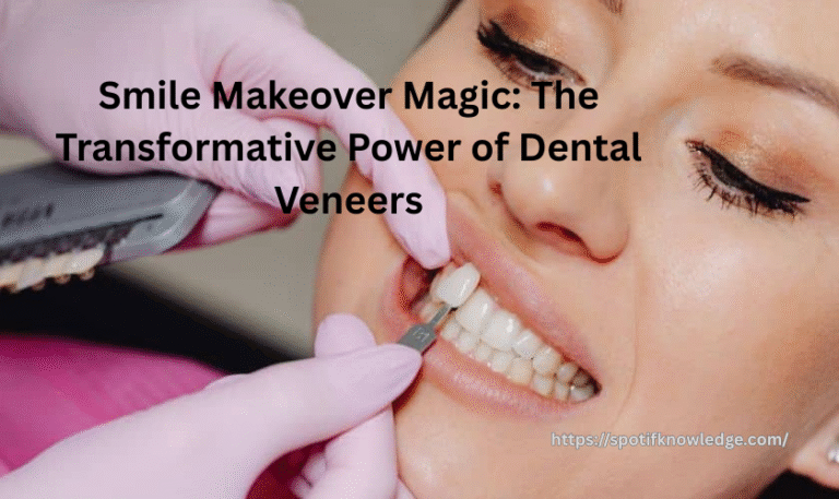 Smile Makeover Magic: The Transformative Power of Dental Veneers
