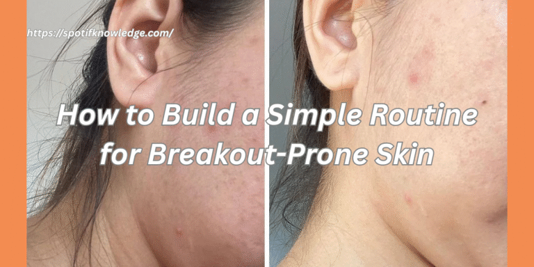 How to Build a Simple Routine for Breakout-Prone Skin