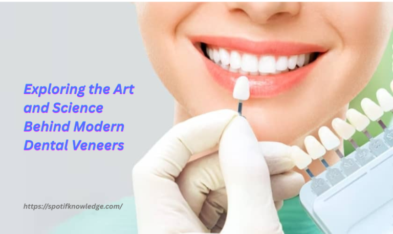 Exploring the Art and Science Behind Modern Dental Veneers